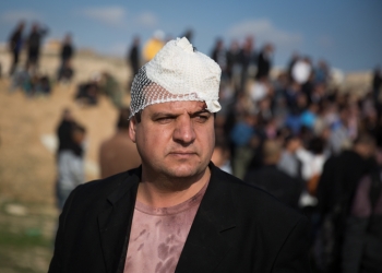 Chairman of the Joint List Arab party, Aiman udeh seen in the Bedouin village of Umm al-Hiran in the Negev desert, in the in the Southern Israel, January 18, 2017. Udeh was injured during clashes that broke out in response to the demolision of several homes in the village, and an alleged terror attack in which a Beduin driver was said to ram into Israeli forces. Photo by Hadas Parush/Flash90 *** Local Caption *** ??? ?? ?????
???
?????
??????
????
?????
????? ????
????
?? ????
????? ????
????
