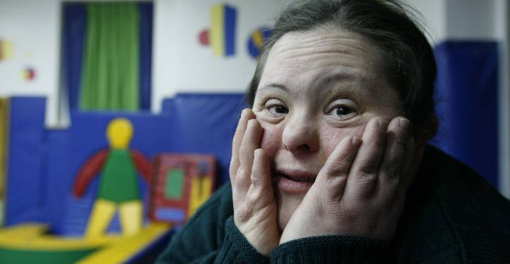 Tamar, a young woman with Downs Syndrome, takes part in  Shalva's special program for older children 21 and above. Founded in 1990, Shalva is a unique program whose mission is to provide developmentally disabled children with a loving environment that helps them reach their full potential. Parents receive the critical respite they desperately need to keep their children at home rather than in a permanent care institution. Shalva has received numerous awards for excellence and works around the clock to treat special children from all walks of life completely free of charge. Photo by Nati Shohat /Flash90 *** Local Caption *** ?????
????
?????
????? ?????? ????? ??????
???? ?????? ???? ????? ???????
?????
???????